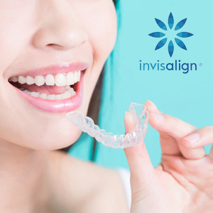 Frequently Asked Questions for Invisalign Treatment in Raleigh