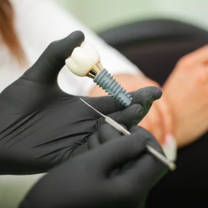 The Step-by-Step Guide to Getting Dental Implants in Raleigh | Smiles of Cary The Step-by-Step Guide to Getting Dental Implants in Raleigh