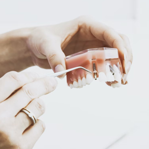 How Dental Implants Preserve Bone Health?