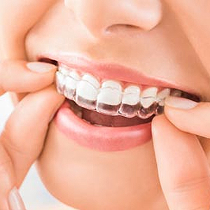 General Dentistry for Invisalign Treatment in Raleigh