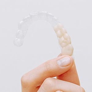 Invisalign Alternative to Straighten Your Teeth | El Paso