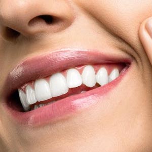 A woman smiling with perfectly white teeth