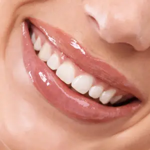 Teeth Whitening Dentist in North Carolina