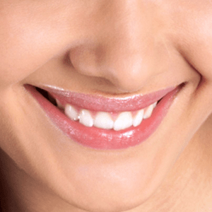 Tooth Extraction as an example of oral surgery in Cary NC