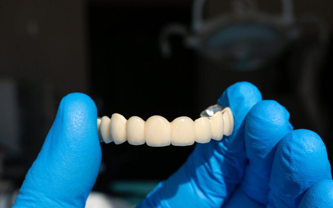 What Causes Plaque on Teeth?